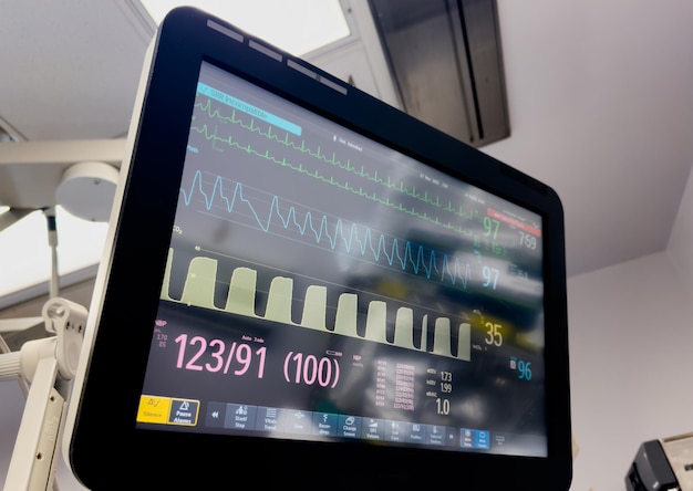 Monitor de hospital que muestra signos vitales frecuencia cardíaca presión arterial temperatura de oxigenamiento y e