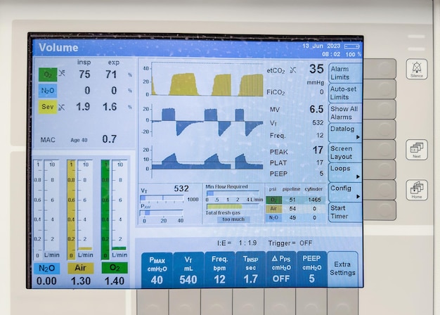 Un monitor de hospital que muestra signos vitales frecuencia cardíaca pulso temperatura de buey presión arterial Symbo