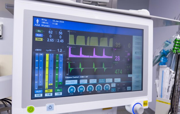 Foto monitor de hospital que muestra signos vitales haciendo hincapié en la tecnología de atención médica y el bienestar del paciente