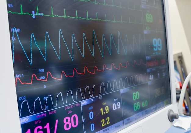 El monitor médico muestra signos vitales con gráficos y números, temperatura de presión arterial y frecuencia cardíaca.