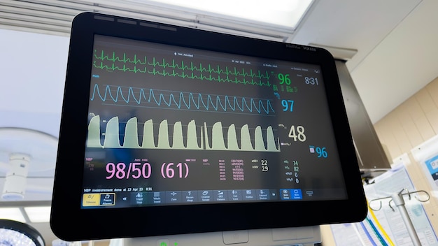 Un monitor con una pantalla de frecuencia cardíaca en él