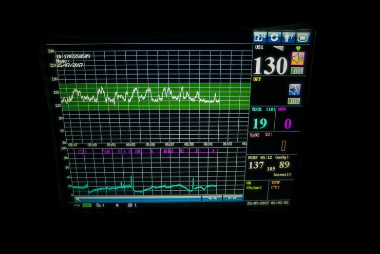 Monitor de signos vitales