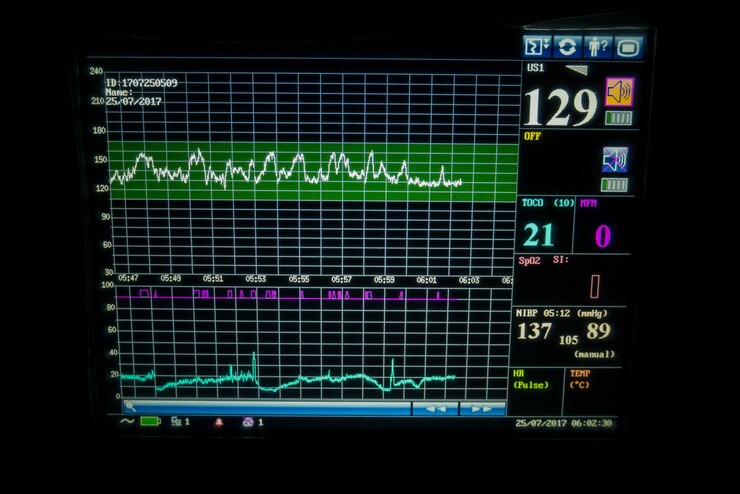 Monitor de signos vitales