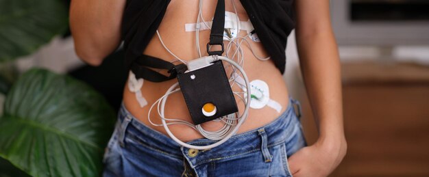 Foto monitoramento de ecg por hora e monitoramento de holter no corpo de uma mulher