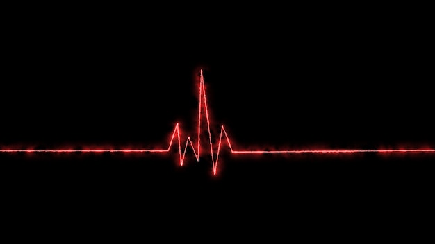 Foto monitoramento de emergência de eletrocardiograma pulso cardíaco de néon azul brilhante batimento cardíaco eletrocardiograma