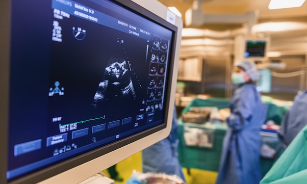 Foto monitoramento ultrassonográfico do coração durante a cirurgia na sala de cirurgia