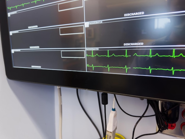 Los monitores hospitalarios simbolizan la importancia de la monitorización continua de los signos vitales, como