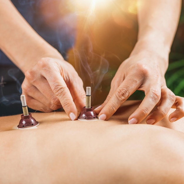 Moxibustion Therapie Traditionelle Chinesische Medizin