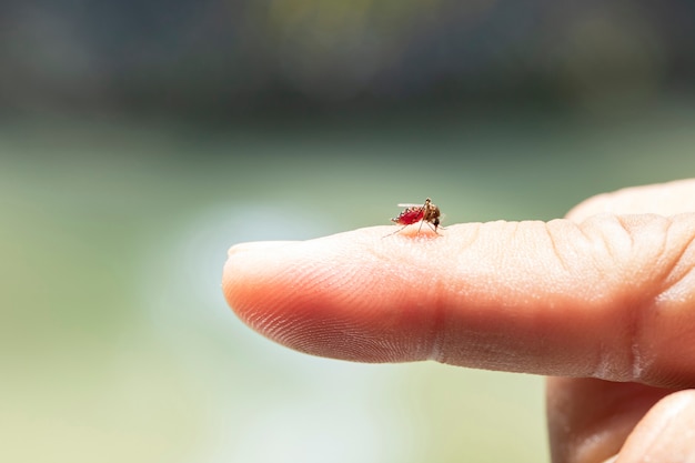 Mückenstichhautpest-Blutverbreitungsvirus menschliches krankes Dengue-Fieber chikungunya zika