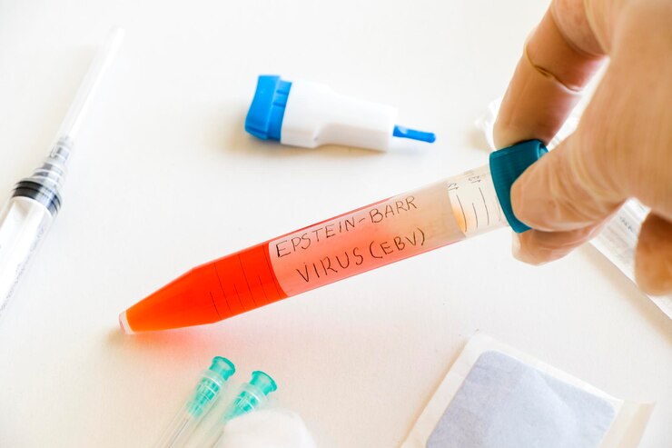 Foto muestra de análisis de sangre para mononucleosis y virus de epstein-barr en el laboratorio en el laboratorio de fondo blanco