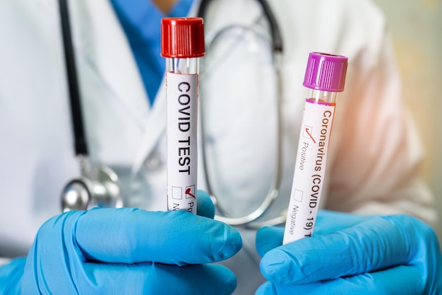 Muestra de infección de sangre positiva en tubo de ensayo para omicron covid19 coronavirus en laboratorio Científico sosteniendo para verificar y analizar el paciente en el hospital