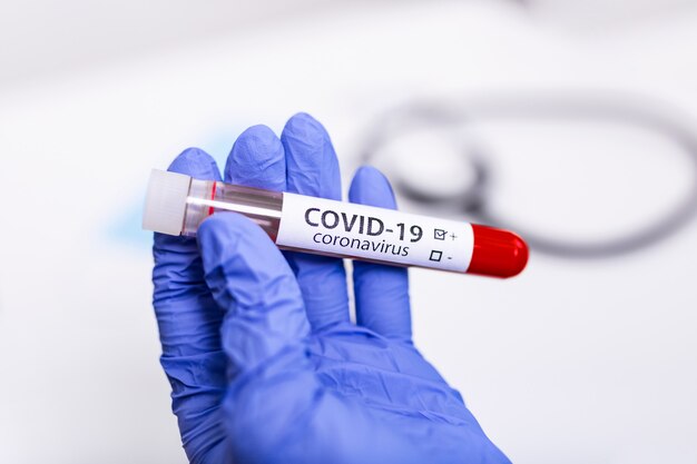 Muestra de sangre infectada con coronavirus covid-19 en un tubo de muestra en la mano del científico de coronavirus con un paño de protección contra riesgos biológicos, investigación de la vacuna de coronavirus covid-19