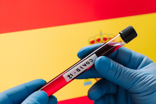 Muestra de sangre infectada en tubo contra el fondo de la bandera de España Brote de coronavirus en Europa Concepto de prueba de virus Diagnóstico de investigación médica