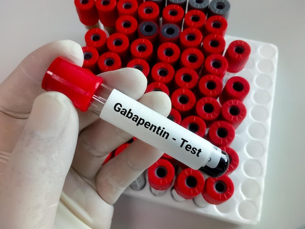 Muestra de sangre para la prueba de gabapentina para establecer la dosis terapéutica