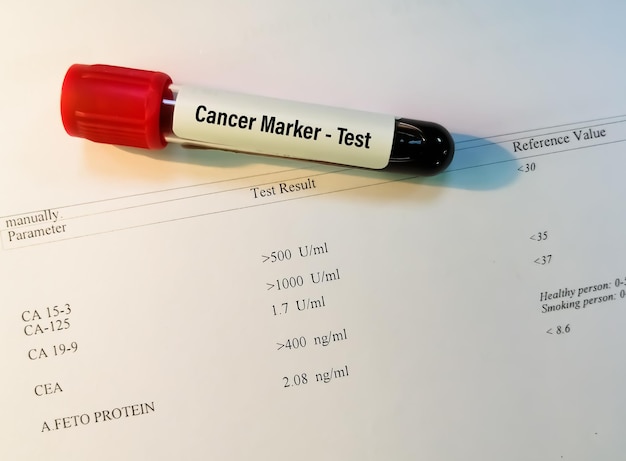 Muestra de sangre para prueba de marcador de cáncer o prueba de marcador tumoral con informe de laboratorio anormal