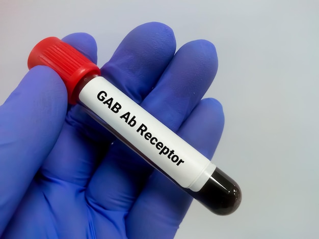 Muestra de sangre para la prueba del receptor Ab del ácido gamma aminobutírico o GAB
