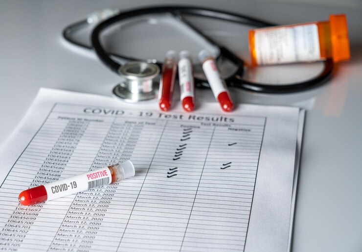 Foto muestra de vista en ángulo alto en el expediente médico