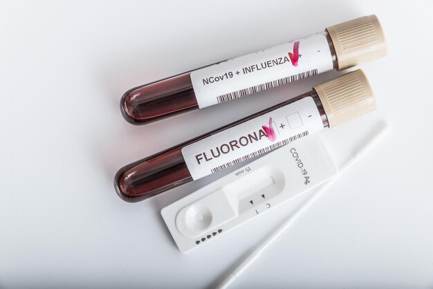 Muestras de sangre de la nueva variante OMICRON plus flu FLUORONE, covid19, coronavirus. Aproximación selectiva al tubo de muestra.