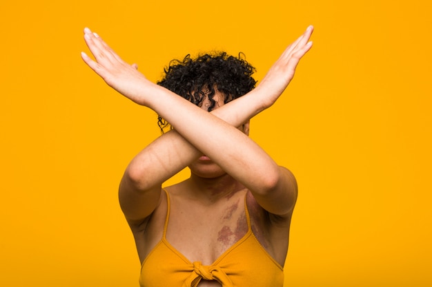 Mujer afroamericana joven con la marca de nacimiento de la piel que mantiene dos brazos cruzados, concepto de la negación.