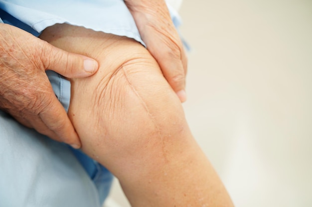 Mujer anciana asiática paciente con cirugía de reemplazo de rodilla con cicatriz en el hospital