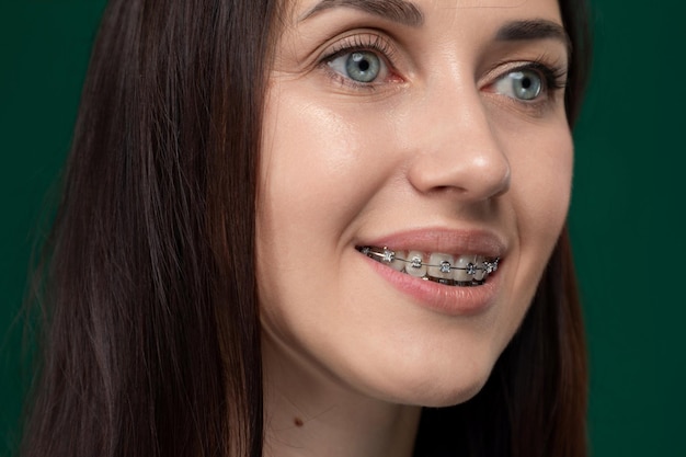 Mujer con aparatos ortopédicos sonriendo