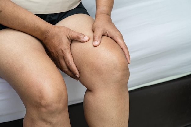 Mujer asiática mujer paciente toca y siente dolor en su rodilla concepto médico saludable