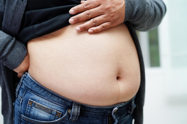 Mujer asiática con sobrepeso usa la mano para apretar el vientre gordo sobrepeso y obesidad de gran tamaño