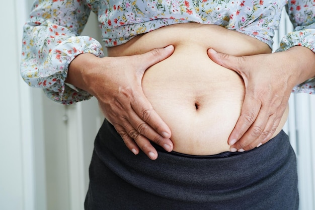 Mujer asiática con sobrepeso usa la mano para apretar el vientre gordo sobrepeso y obesidad de gran tamaño