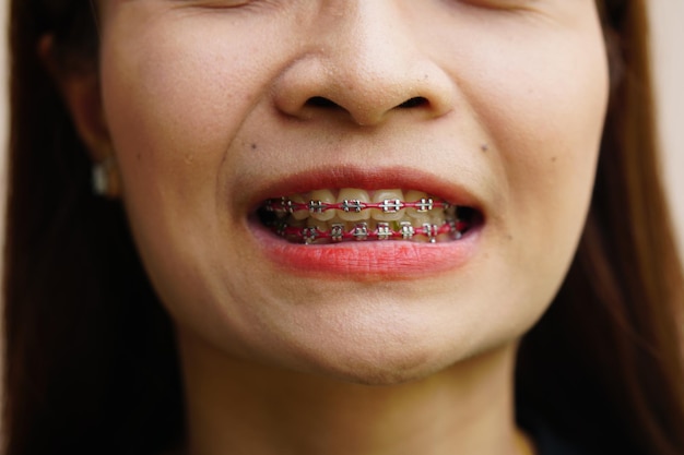 mujer asiática, sonriente, en, llaves