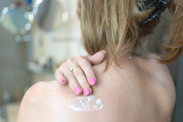 Mujer blanca aplicando crema hidratante en la espalda para el cuidado de la piel