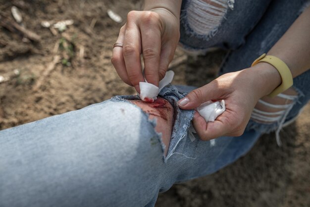 mujer, cicatrización, sangriento, herida, en, mans, rodilla, cicatrizarse