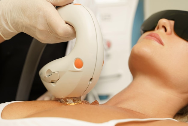 Mujer cliente durante el tratamiento IPL en una clínica médica de cosmetología