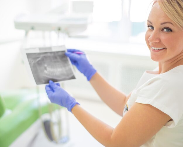 Mujer dentista sosteniendo una radiografía dental La enfermera sostiene una radiografía de la mandíbula humana y señala un diente con caries Oficina Periodoncista