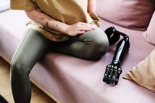 Mujer con discapacidad usando prótesis