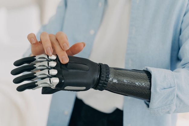 Foto una mujer discapacitada toca un miembro del brazo artificial de alta tecnología cerca de la publicidad biónica de prótesis de mano