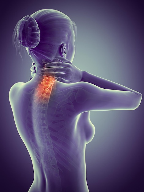 mujer con dolor en el cuello y columna vertebral visible