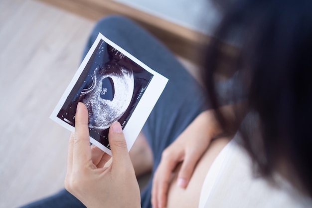 Una mujer embarazada está mirando una foto de ultrasonido del feto. La madre toca suavemente al bebé en el estómago. Las mujeres están embarazadas durante 23 días o durante el primer trimestre.