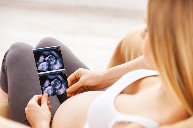 Mujer embarazada con imagen de rayos x. Vista superior de la hermosa mujer embarazada sentada en la silla y sosteniendo la imagen de rayos x de su bebé