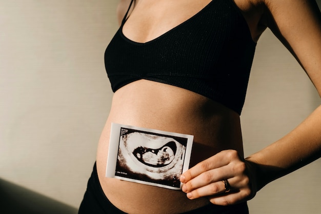 Mujer embarazada con imagen de ultrasonido de bebé delante de su vientre.