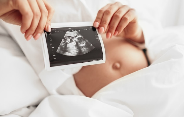 Foto mujer embarazada irreconocible que demuestra la ecografía del bebé mientras descansa en la cama