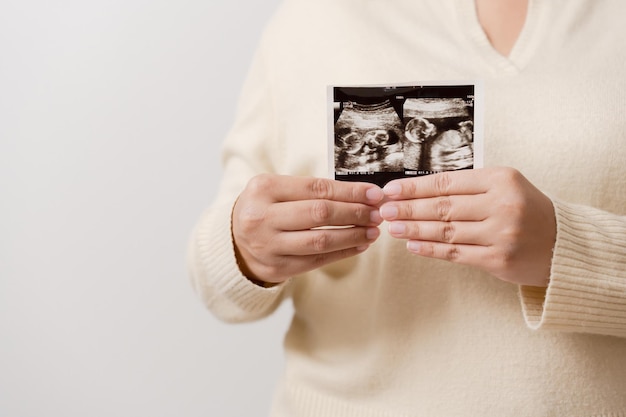 Mujer embarazada sosteniendo una película de ultrasonido de su bebé Madre feliz y bebé recién nacido en proceso