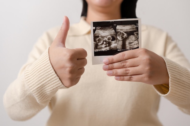 Mujer embarazada sosteniendo una película de ultrasonido de su bebé Madre feliz y bebé recién nacido en proceso