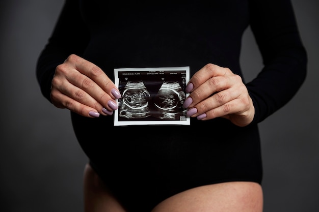 Mujer embarazada en un traje negro con una gran barriga con una ecografía. Fondo gris.