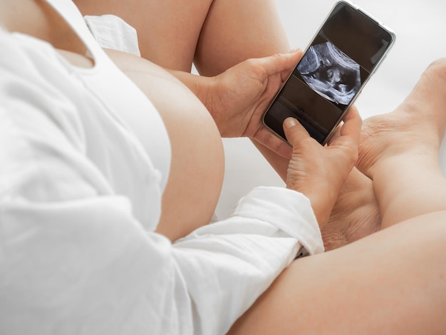 Una mujer embarazada vestida de blanco con una gran barriga desnuda mira una ecografía de su hijo