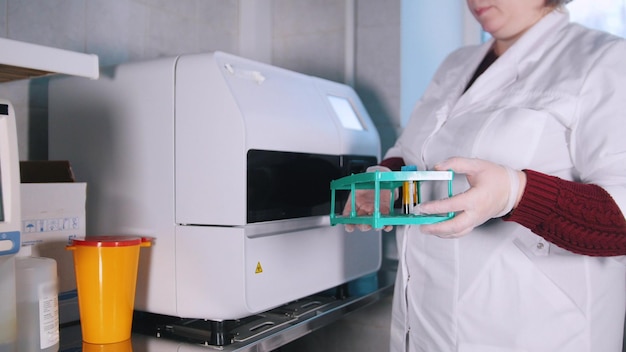 La mujer está haciendo una prueba química de sangre en un laboratorio médico