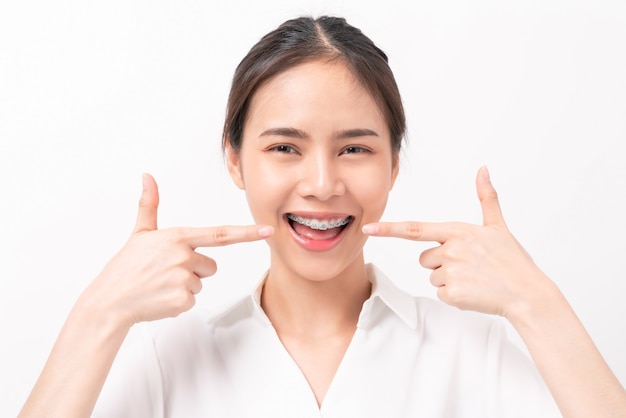 mujer con frenillos en los dientes.