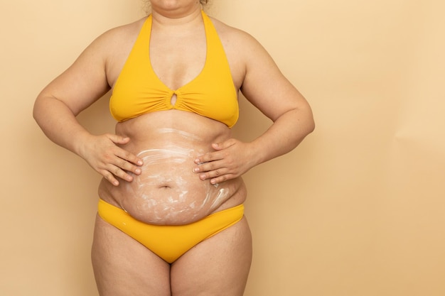 Mujer gorda en traje de baño amarillo aplica crema corporal blanca sobre un fondo beige grueso y caído Adelgazamiento lucha contra el sobrepeso obesidad y celulitis Personas de talla grande y concepto positivo para el cuerpo