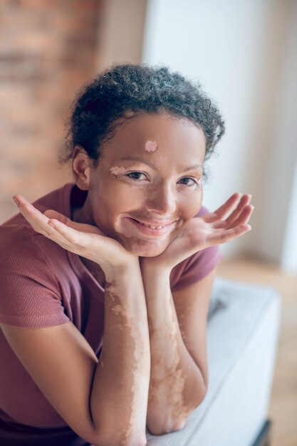 Mujer guapa. Linda mujer joven con pigmentación en su rostro mirando sincero y dulce