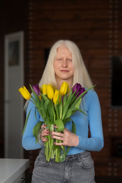 Foto mujer joven con albinismo y flores de tulipán.