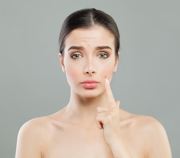 Mujer joven con espinilla de acné Problema de la piel femenina Tratamiento facial cosmetología y concepto de cuidado de la piel